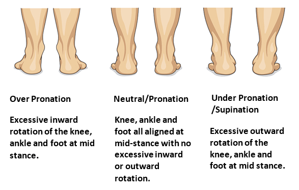 What is overpronation or underpronation? New Balance FAQs