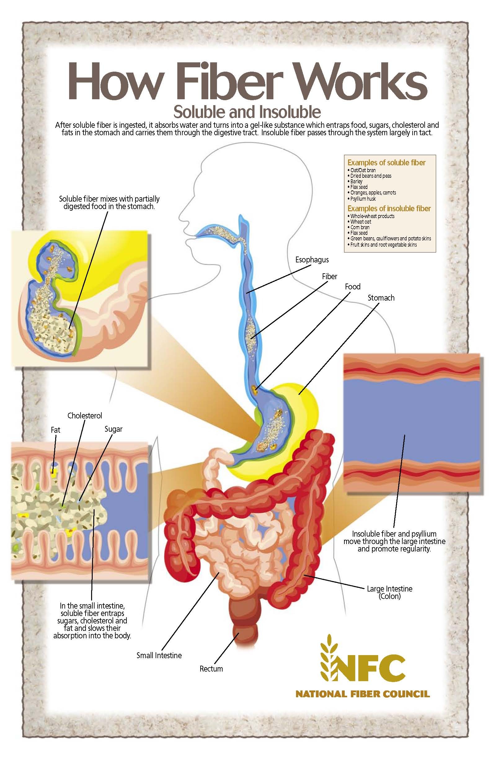 Eating with an Ostomy Newbie Ostomy
