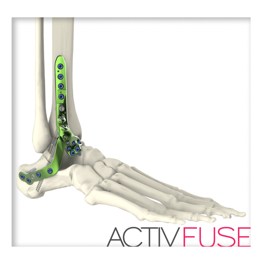 Ankle Solutions Newclip Technics