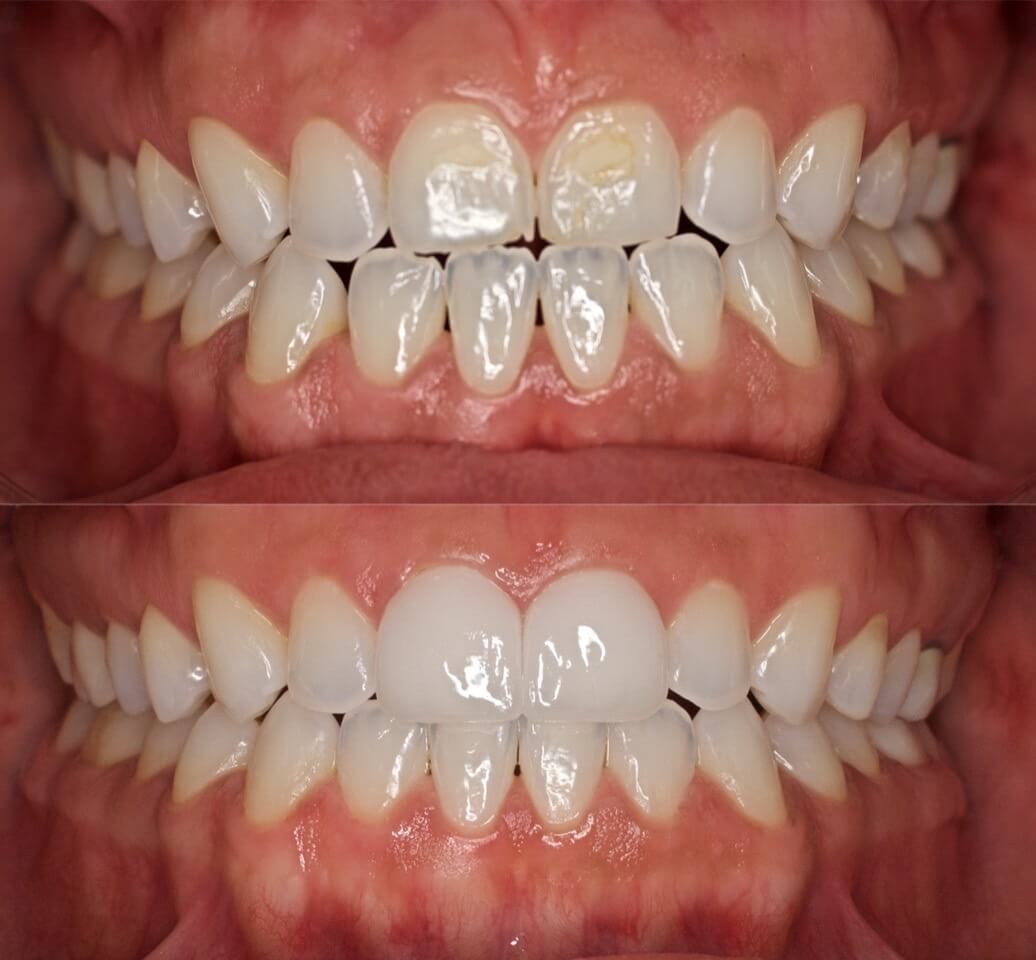 Success Stories New Image Dental Laboratory