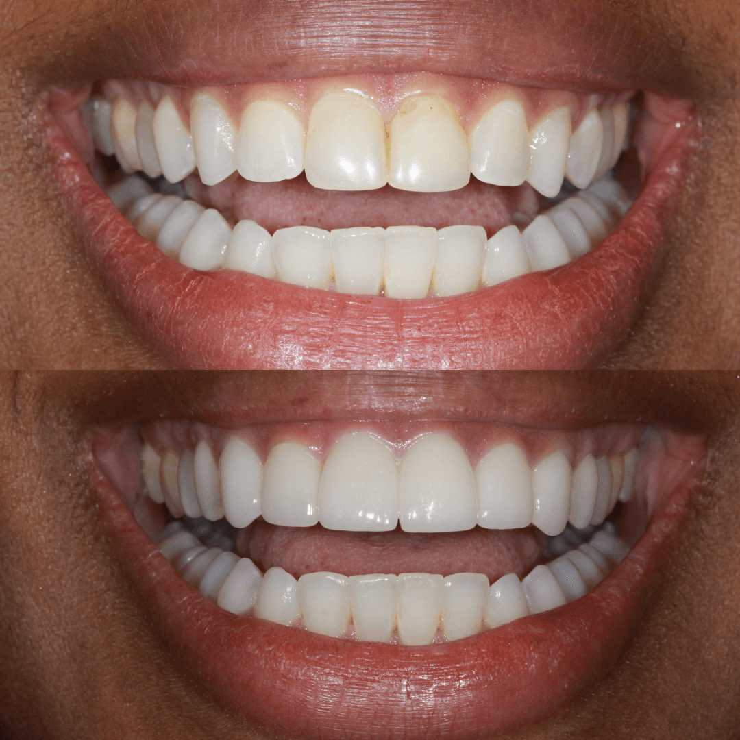 Success Stories New Image Dental Laboratory