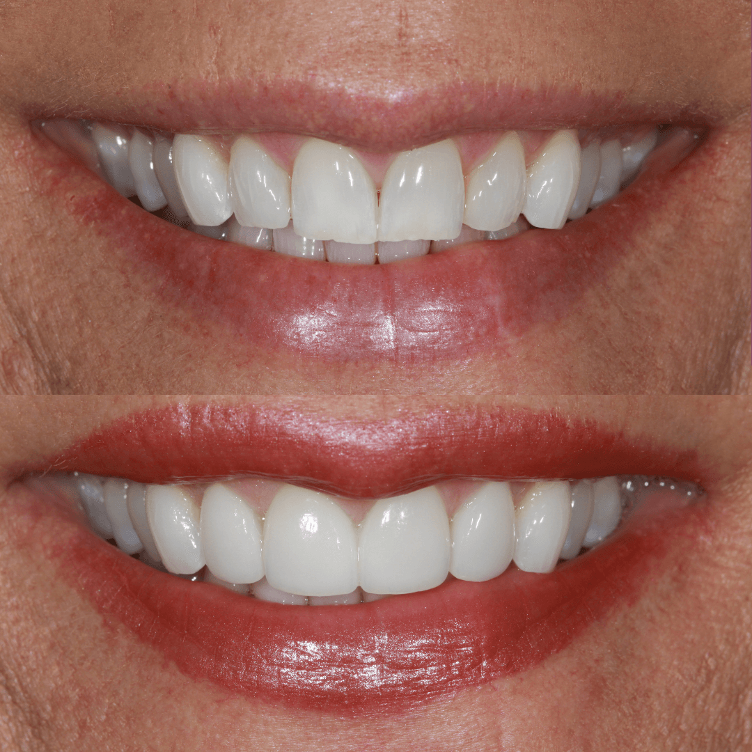 Success Stories New Image Dental Laboratory