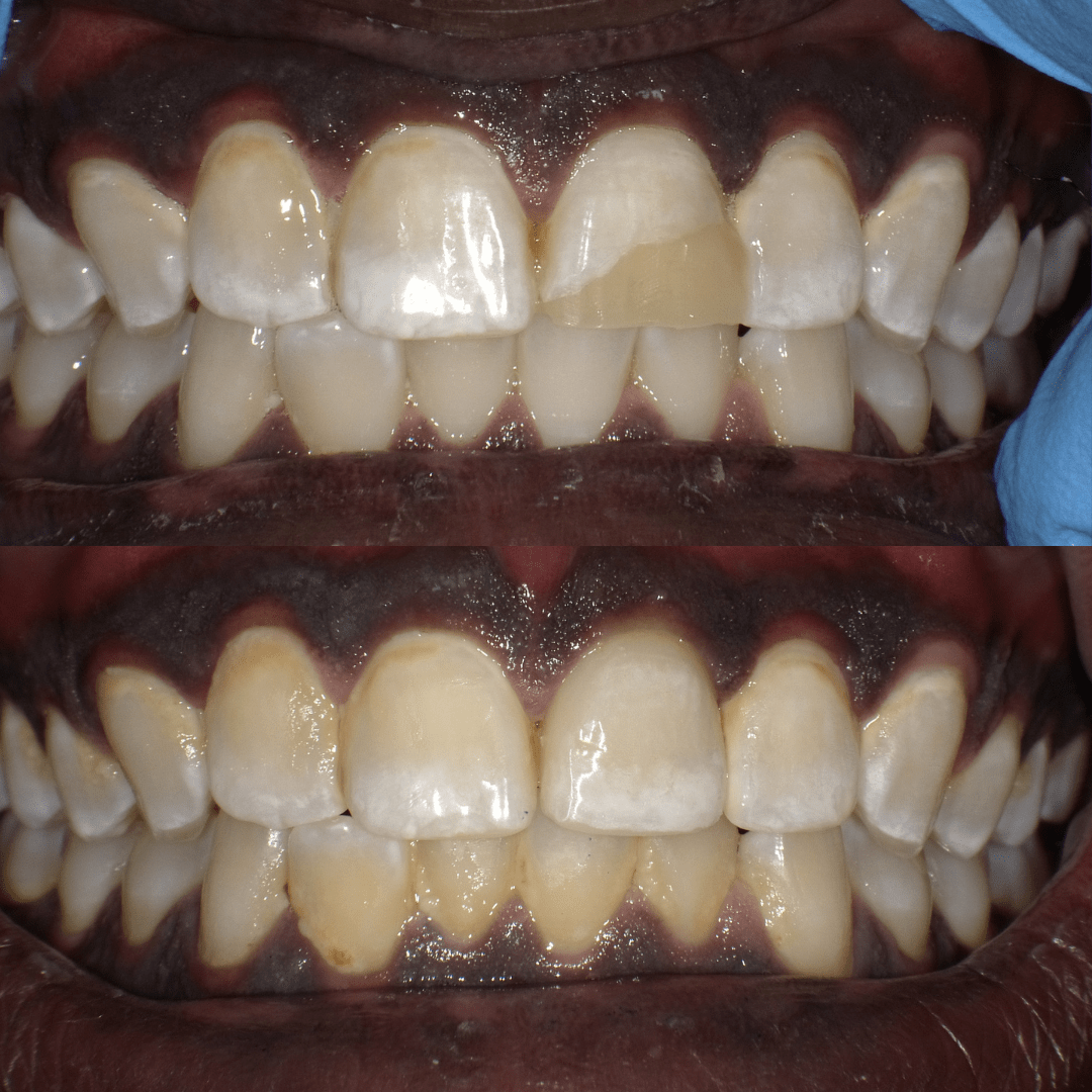 Success Stories New Image Dental Laboratory