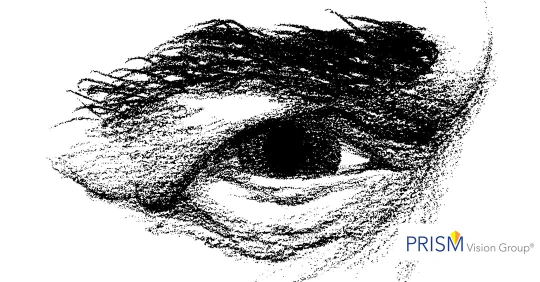 Eye Drops for Droopy Eyelids The Eye Care & Surgery Center