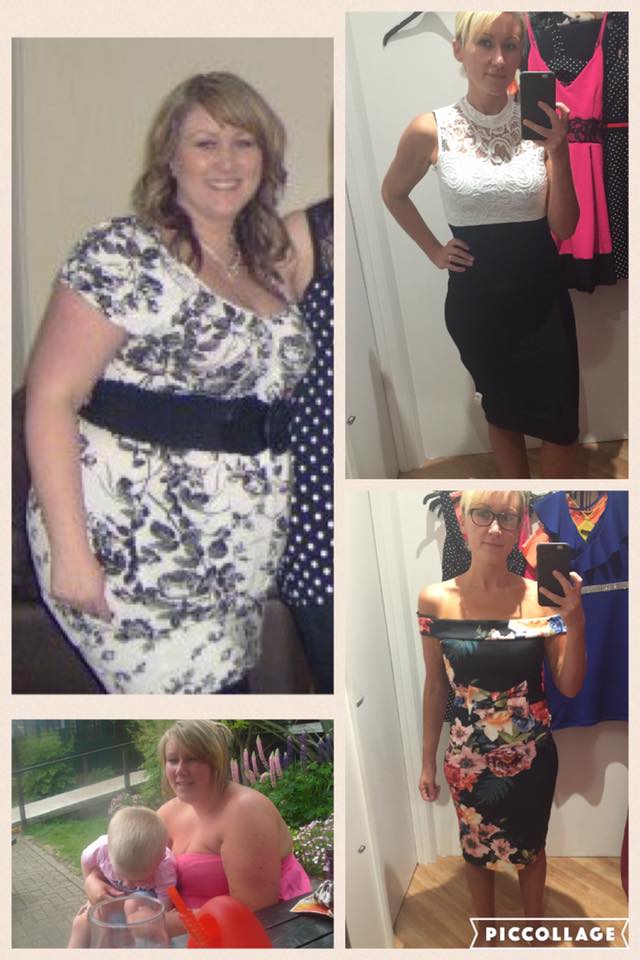 Weight Loss Surgery What our Patients Say New Leaf Weight Loss Surgery