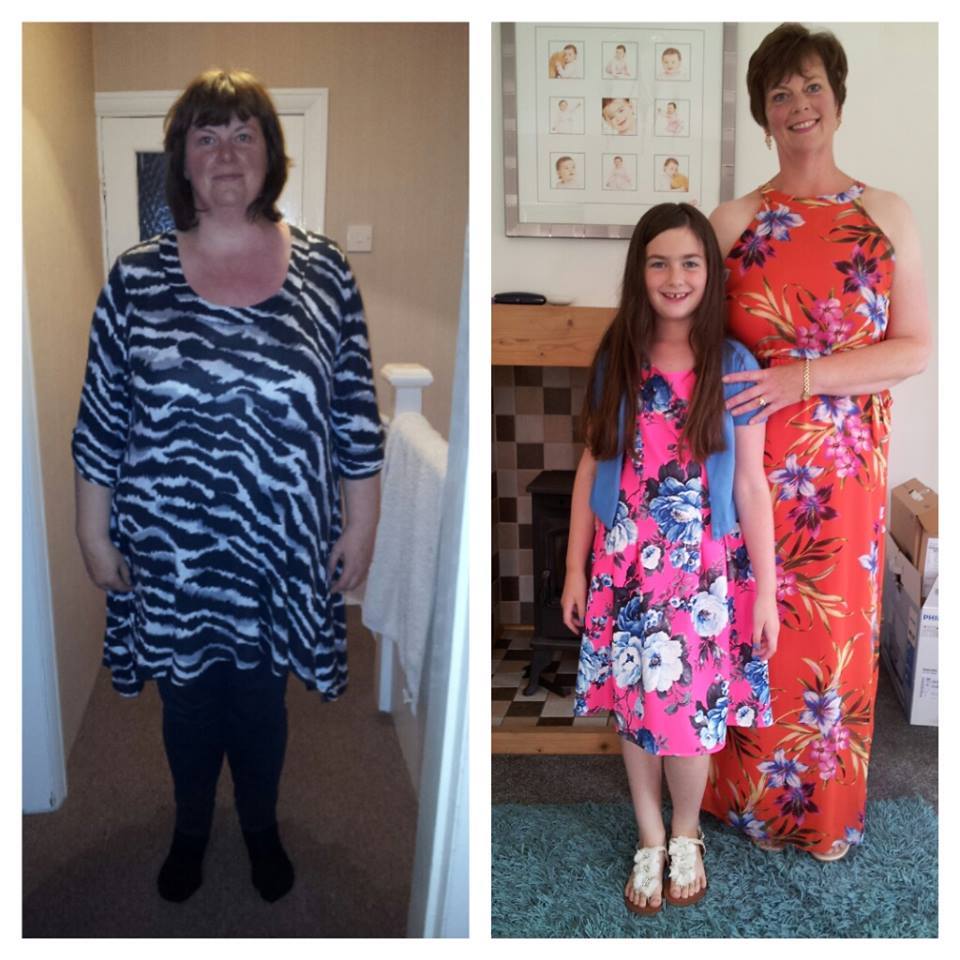 Weight Loss Surgery What our Patients Say New Leaf Weight Loss Surgery