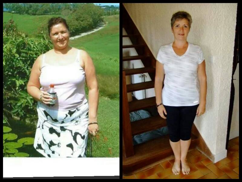 Weight Loss Surgery What our Patients Say New Leaf Weight Loss Surgery