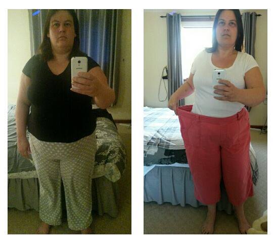 Weight Loss Surgery What our Patients Say New Leaf Weight Loss Surgery