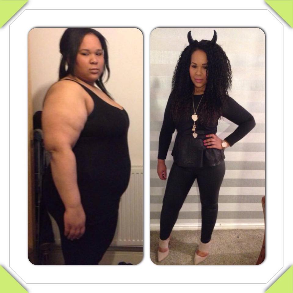 Weight Loss Surgery What our Patients Say New Leaf Weight Loss Surgery