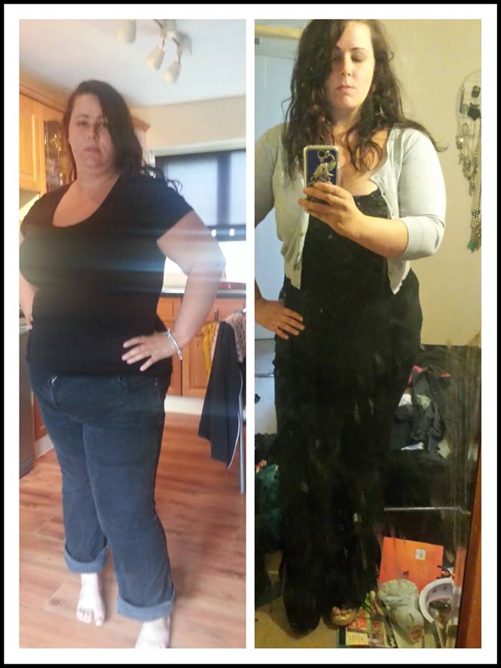 Weight Loss Surgery What our Patients Say New Leaf Weight Loss Surgery