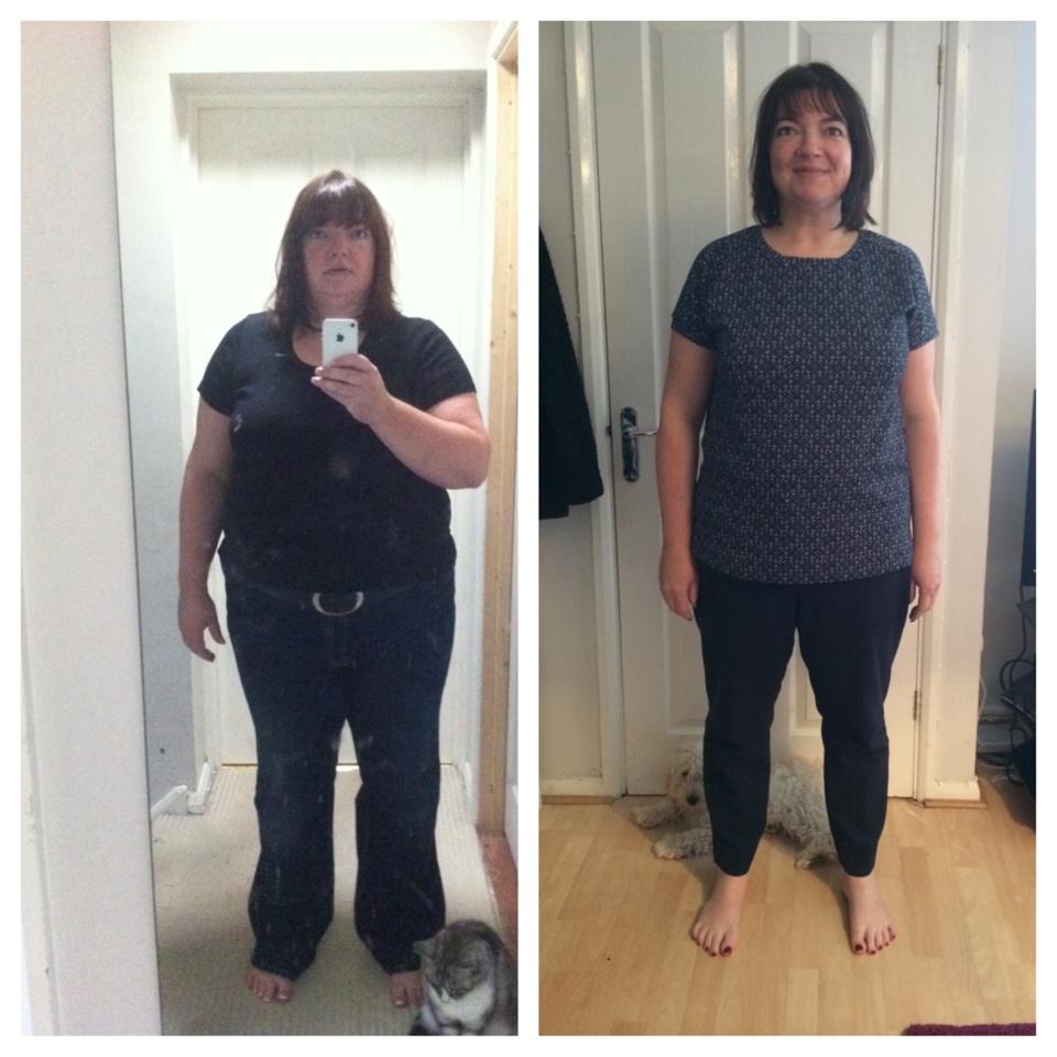 Weight Loss Surgery What our Patients Say New Leaf Weight Loss Surgery