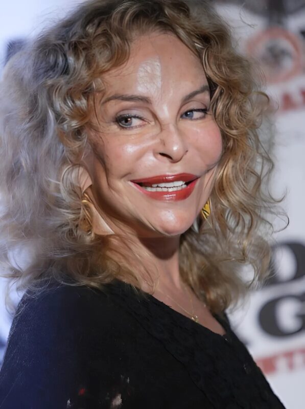 She was once adored by millions, but plastic surgery has drastically