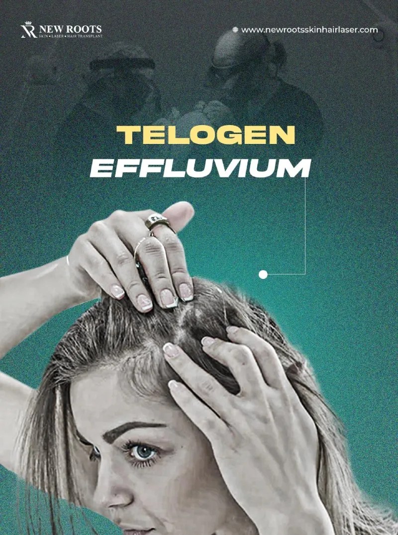 Shocking Truth About Long Hair Receding Hairline in 2025(03)