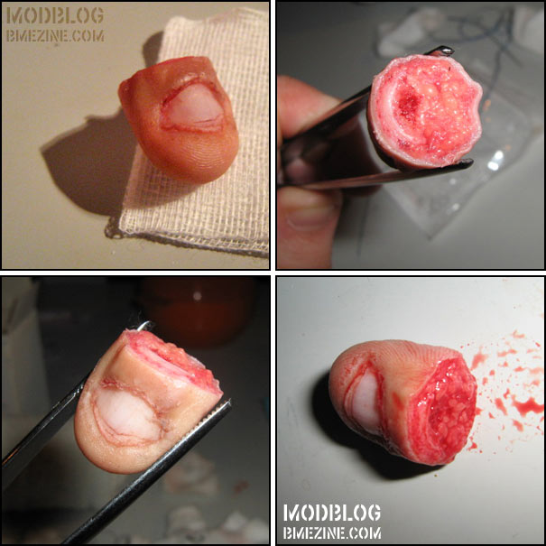 DIY Finger Amputation BME Tattoo, Piercing and Body Modification News