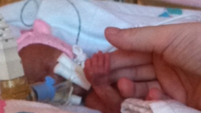 3 Month Premature Baby Newborn baby