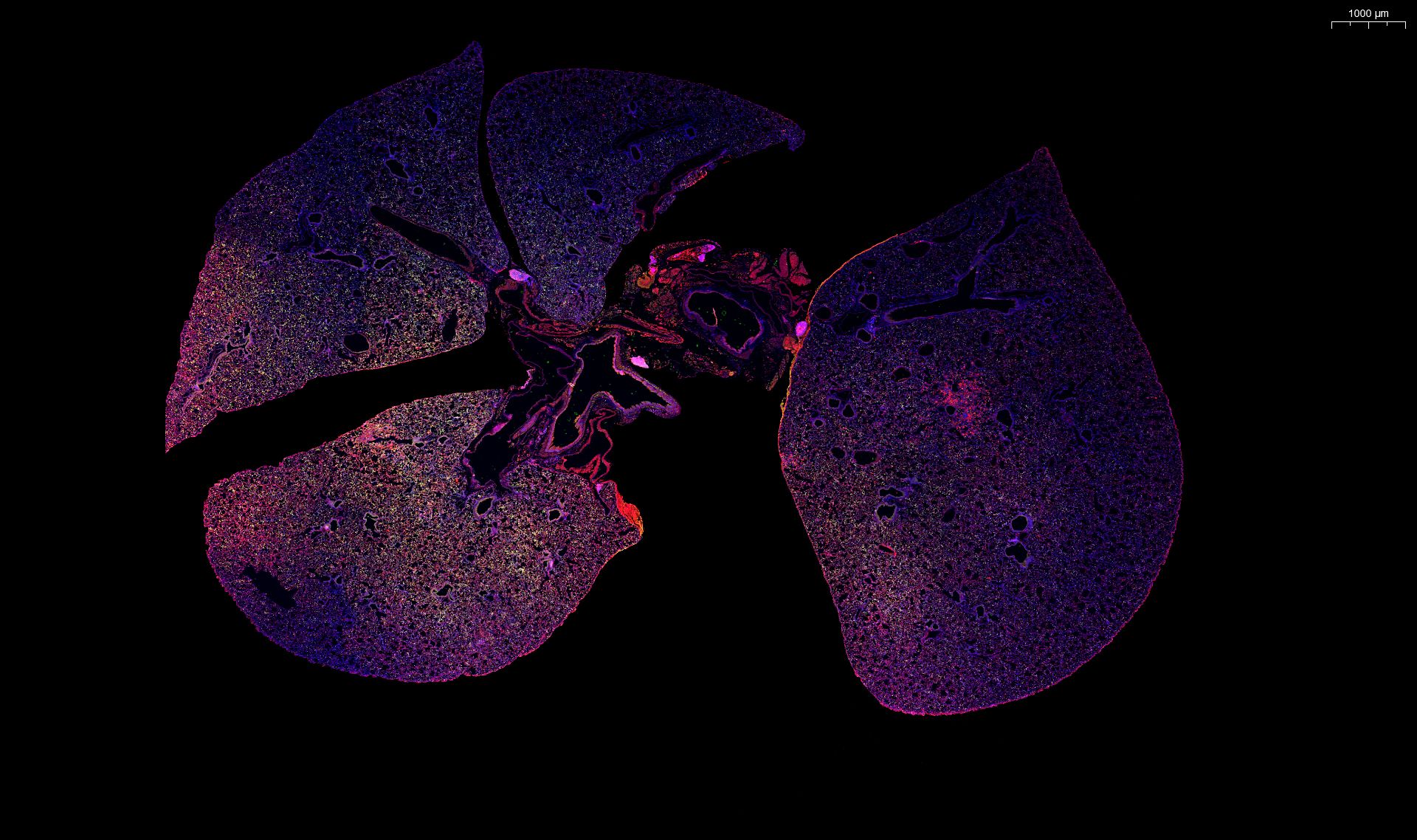 With these nanoparticles, a simple urine test could diagnose bacterial