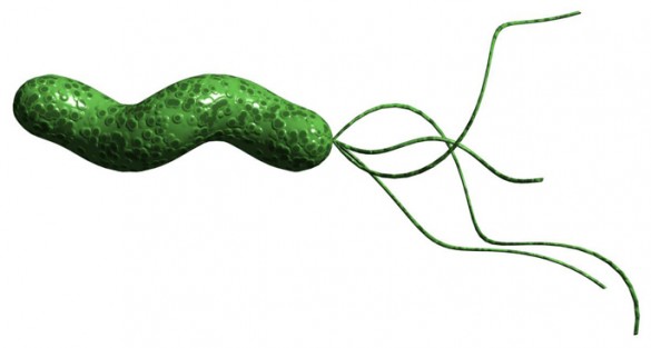 Diagnosis H Pylori Diagnosis