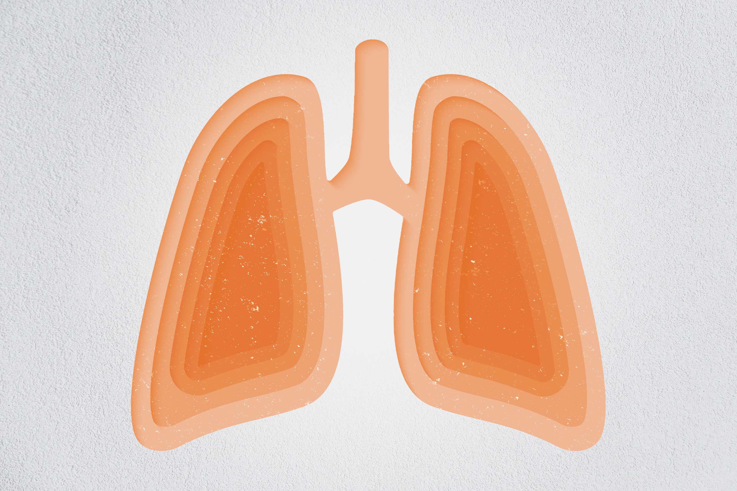No Simple Fix Time May Be the Most Reliable Cure for a Chronic Cough