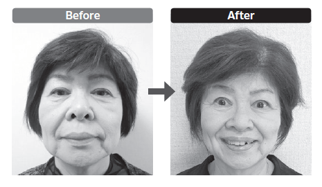 ブルドッグ顔になりやすい習慣10選 ５秒で顔面改革！ブルドッグ顔解消の顔トレ本発売 美顔のカリスマ考案の最新メソッドを紹介 | Newscast