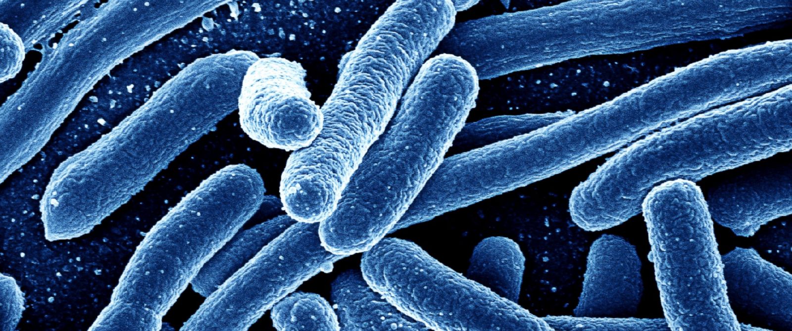 Deadly new strain of antibioticresistant yeast infection set to invade
