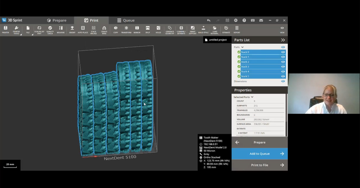 3D Sprint Software New features and workflows for your NextDent 5100
