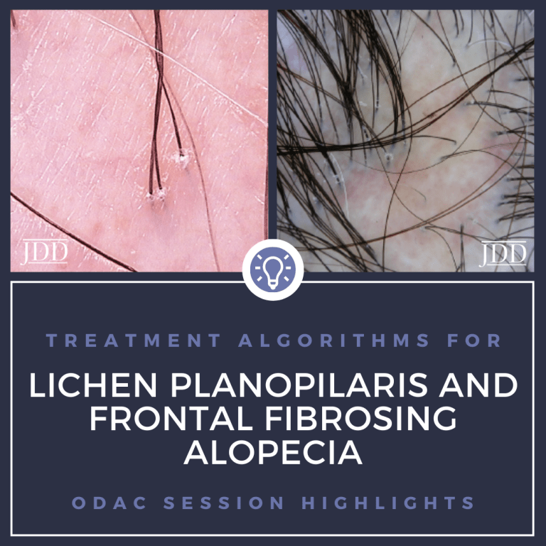 Lichen Planopilaris and Frontal Fibrosing Alopecia Treatment Algorithms Next Steps in Dermatology