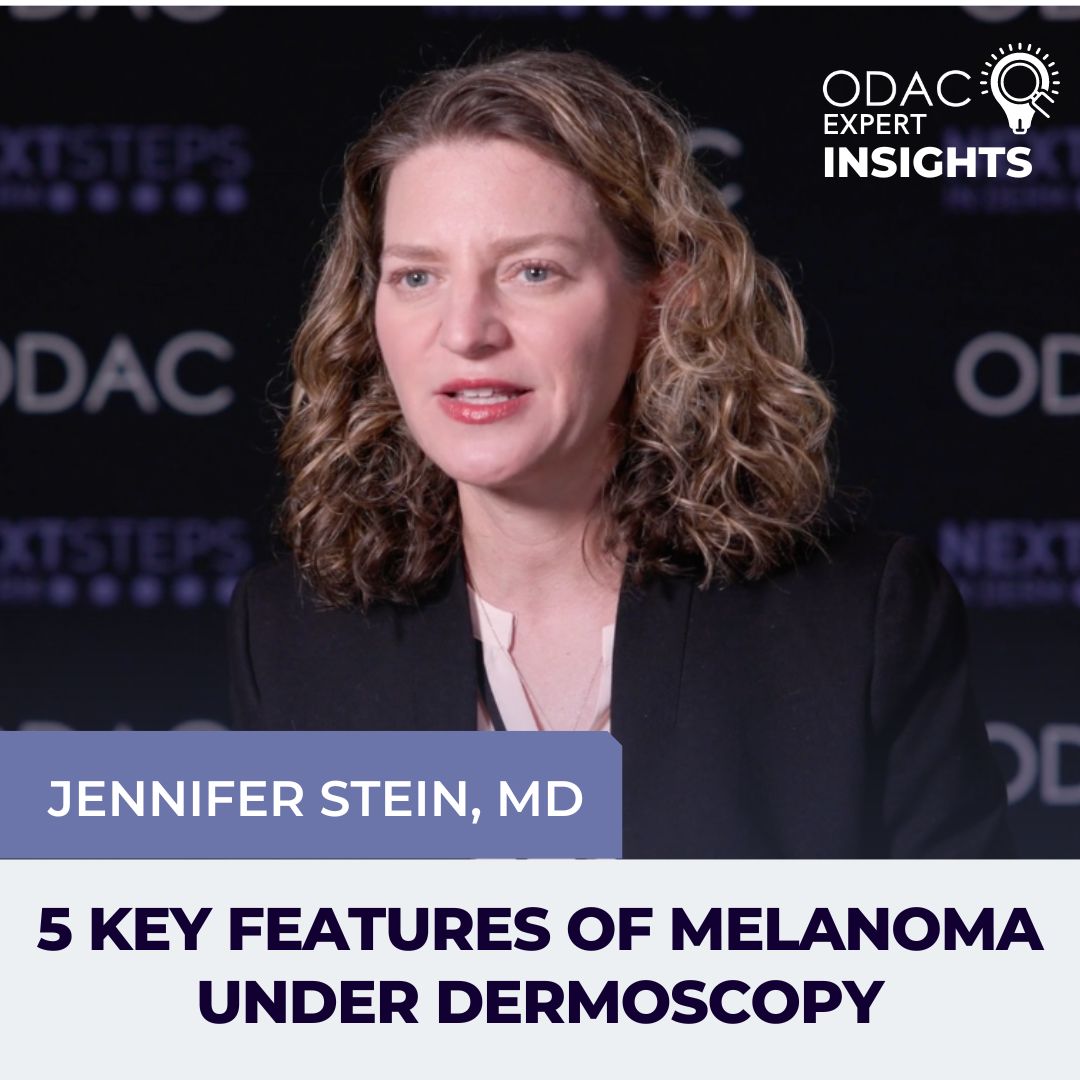 5 Key Features of Melanoma Under Dermoscopy Next Steps in Dermatology