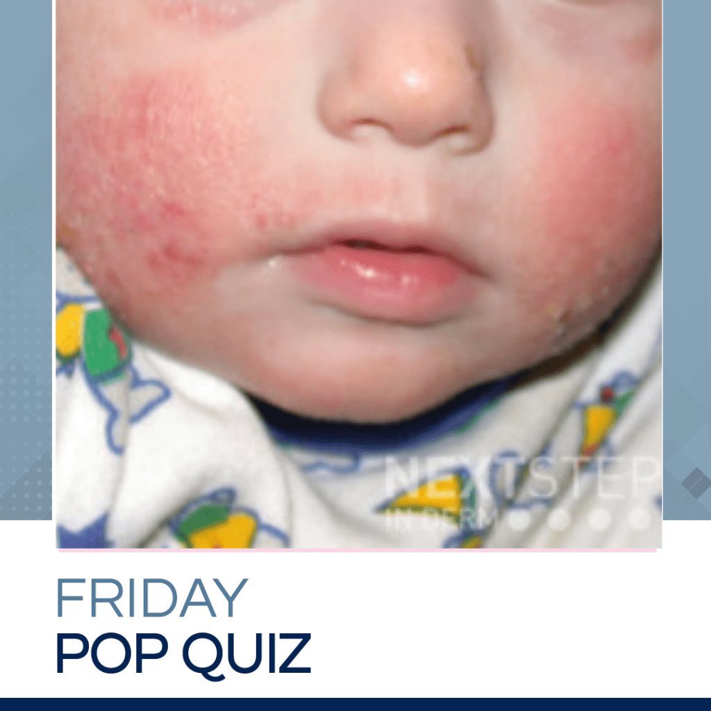 Derm InReview Archives Page 2 of 71 Next Steps in Dermatology