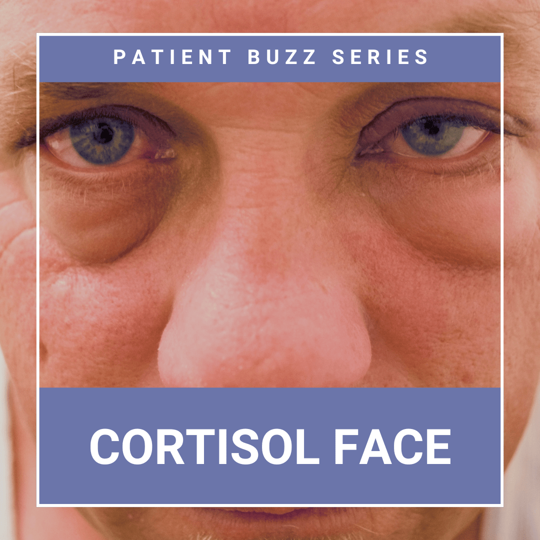 Cortisol Face (1) Next Steps in Dermatology