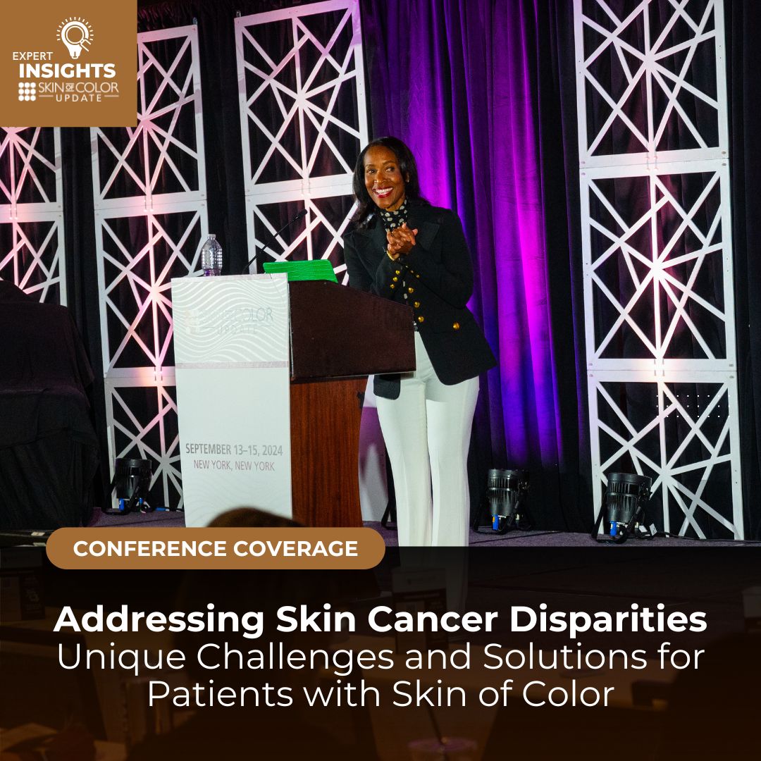 skin cancer in Hispanic patients Archives Next Steps in Dermatology