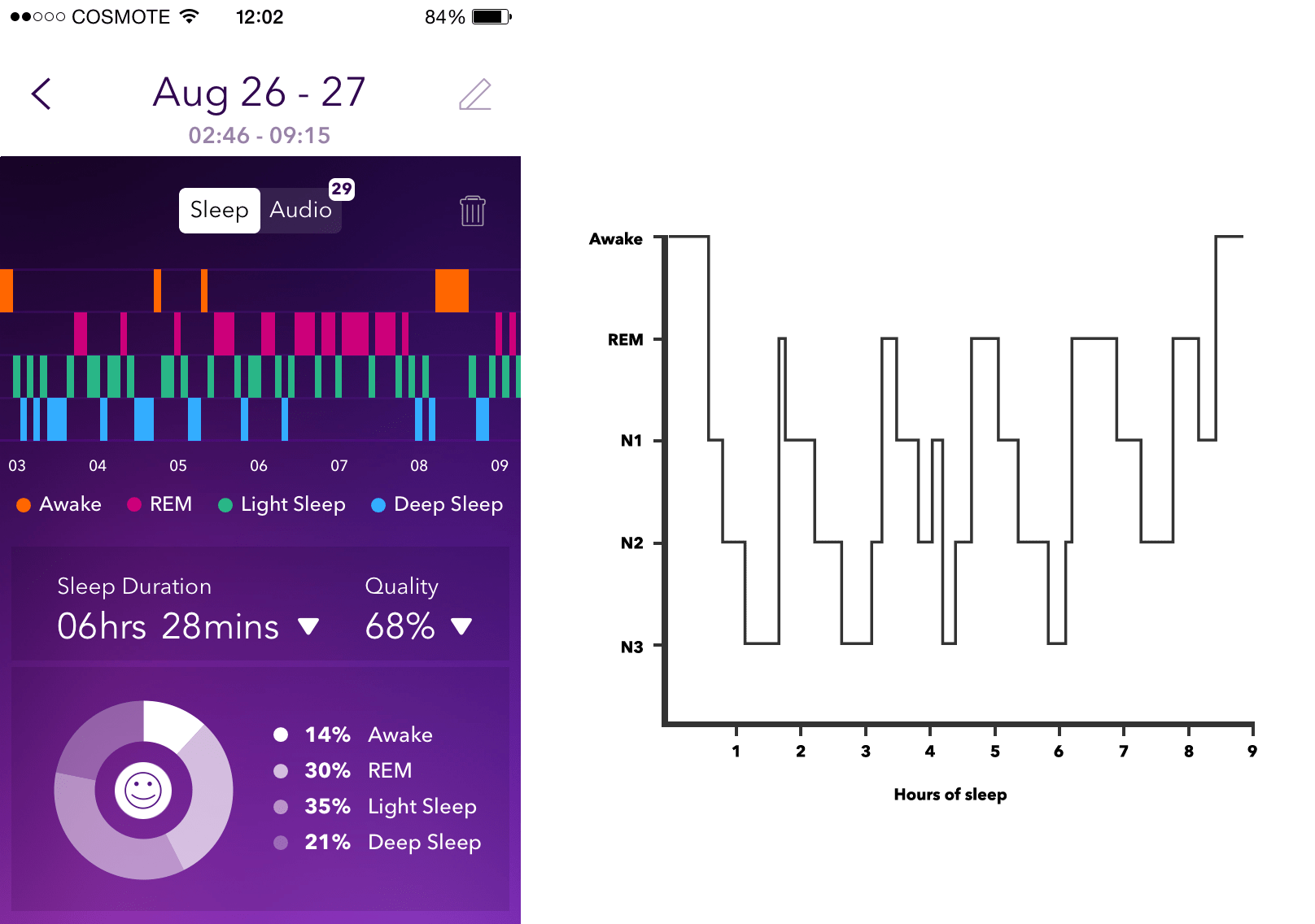 [DIAGRAM] Normal Sleep Diagram