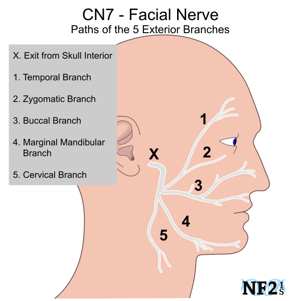 CN7 Facial Nerve Damage