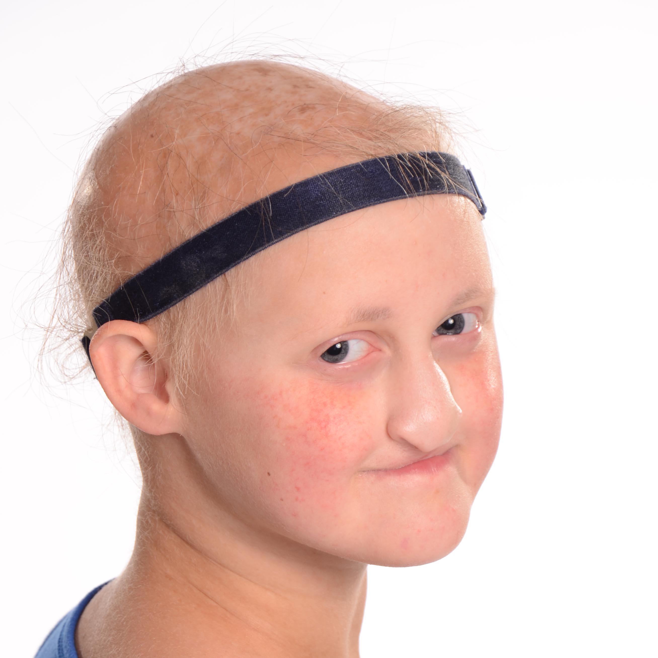 Dermatology Grand Rounds Virginia NFED