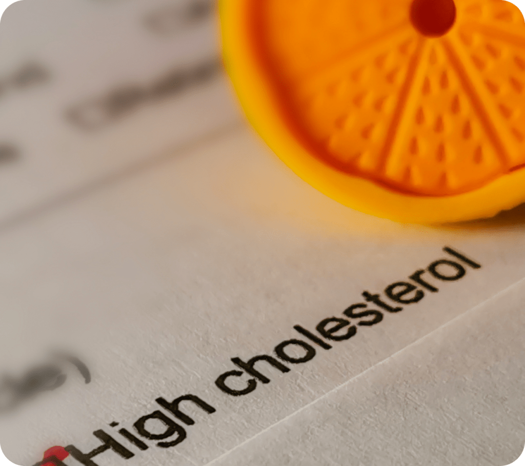 High cholesterol levels New Generation of Medical Research