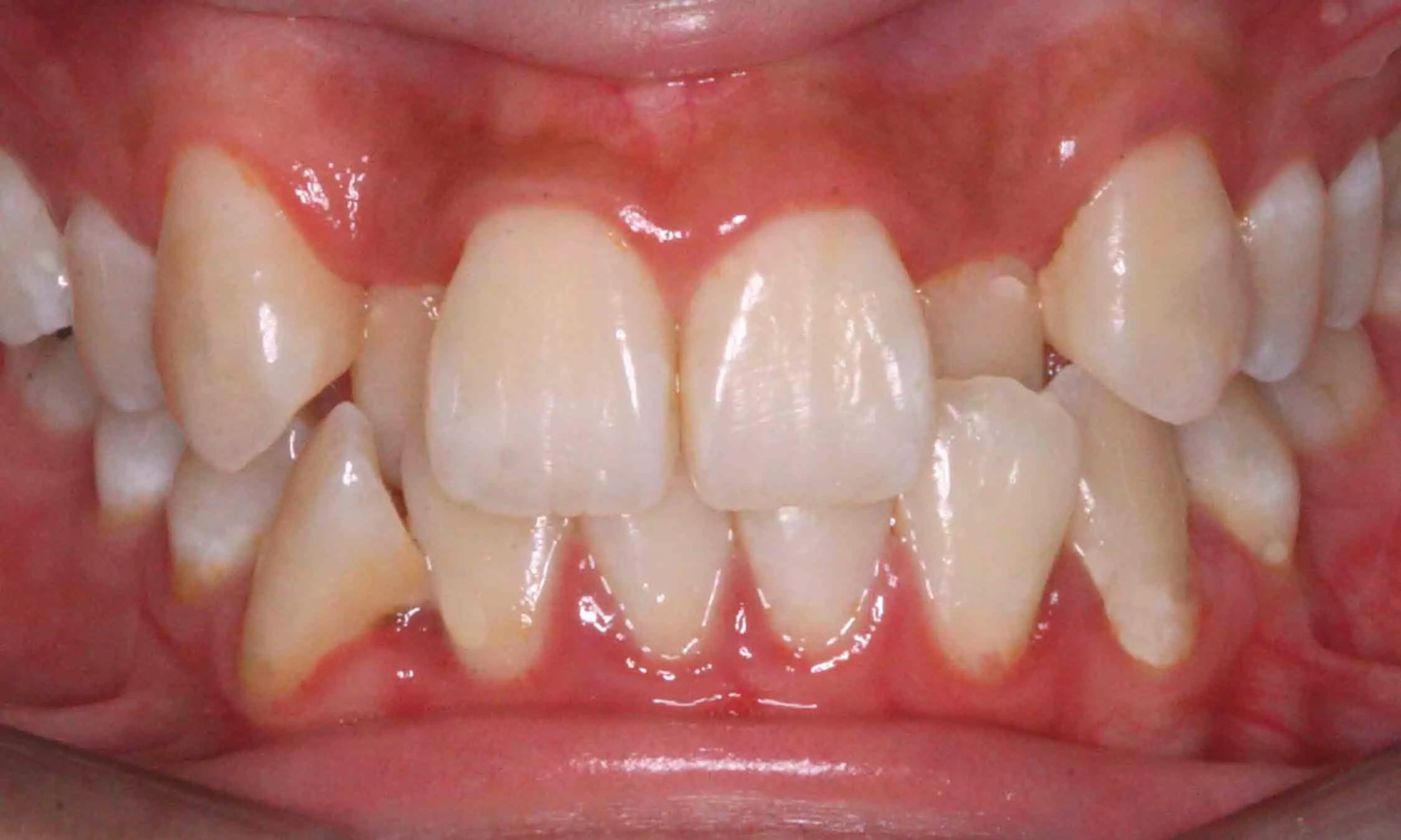 What Is Orthodontic? Price List, Procedure, And Important Considerations