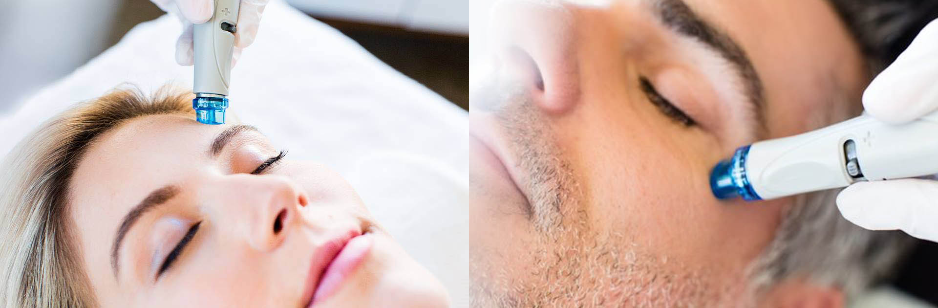 Hydrafacial MD Naturheilpraxis Holm und Bogdany in