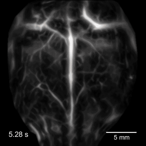 Laser pulses drum up sharp images of organs in motion