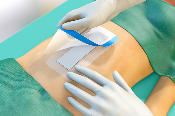 Sorbact® Surgical Dressing Nibykan