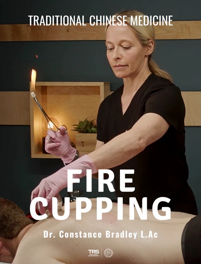 TCM Fire Cupping (5 hrs) Niel Asher Education