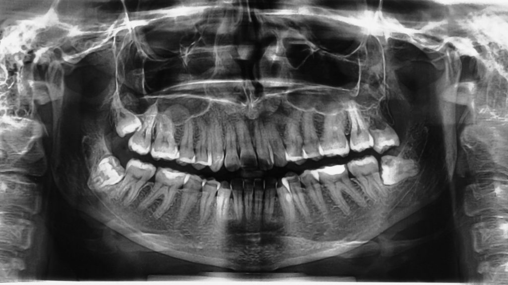 Medical Billing for Cone Beam Computed Tomography (CBCT) Nierman