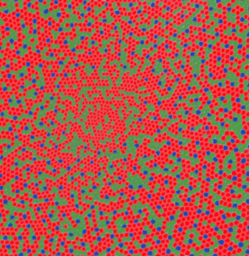 Why is vision grainy at night or in dark areas? r/askscience