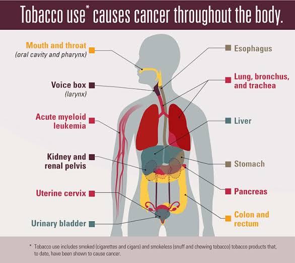 See the List of Cancers Caused by Smoking Nigerian Health Blog