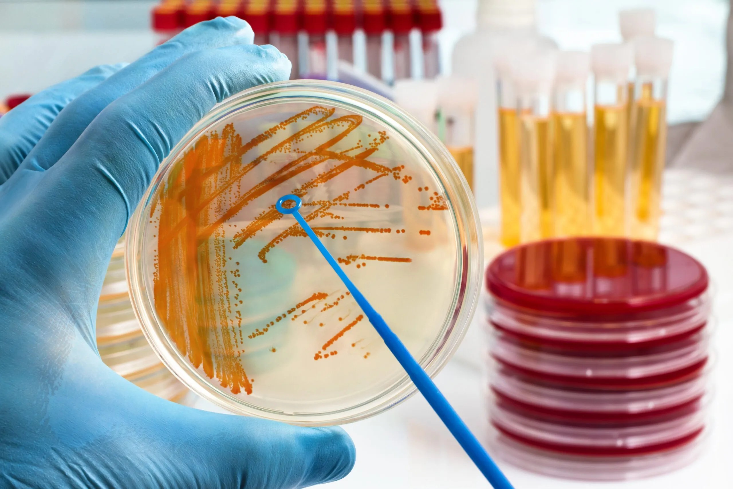 AdobeStock_152781745microbiologytestingimagescaled NJ Labs