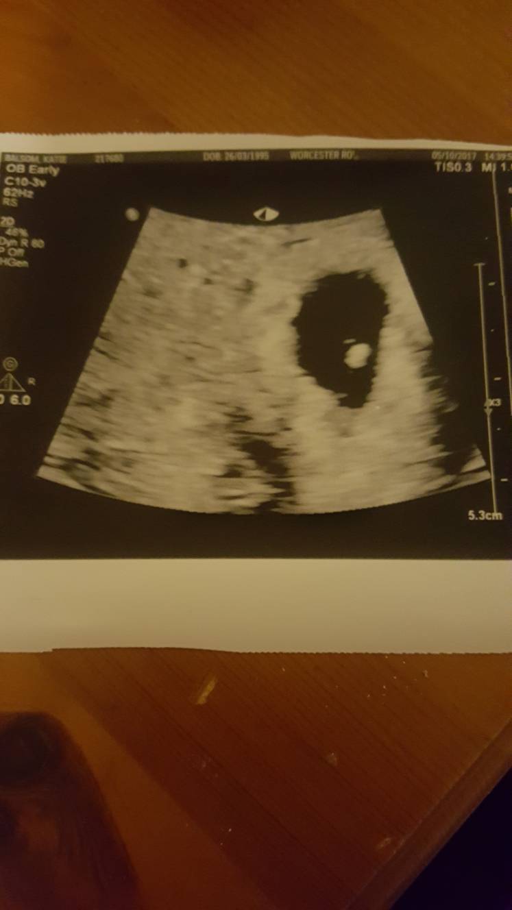 7 weeks. Light pink spotting and period pains