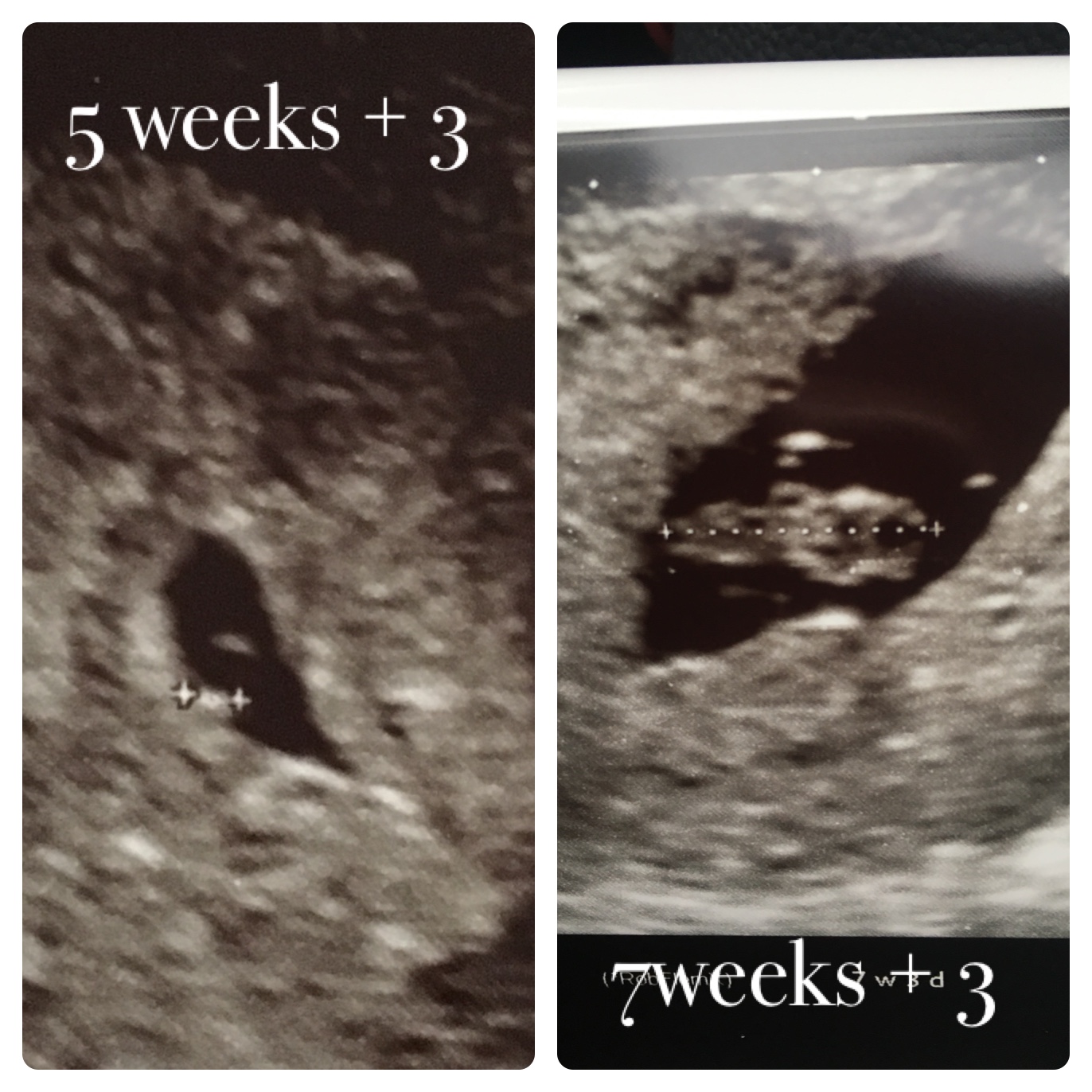 Early scan tomorrow. What can i expect?