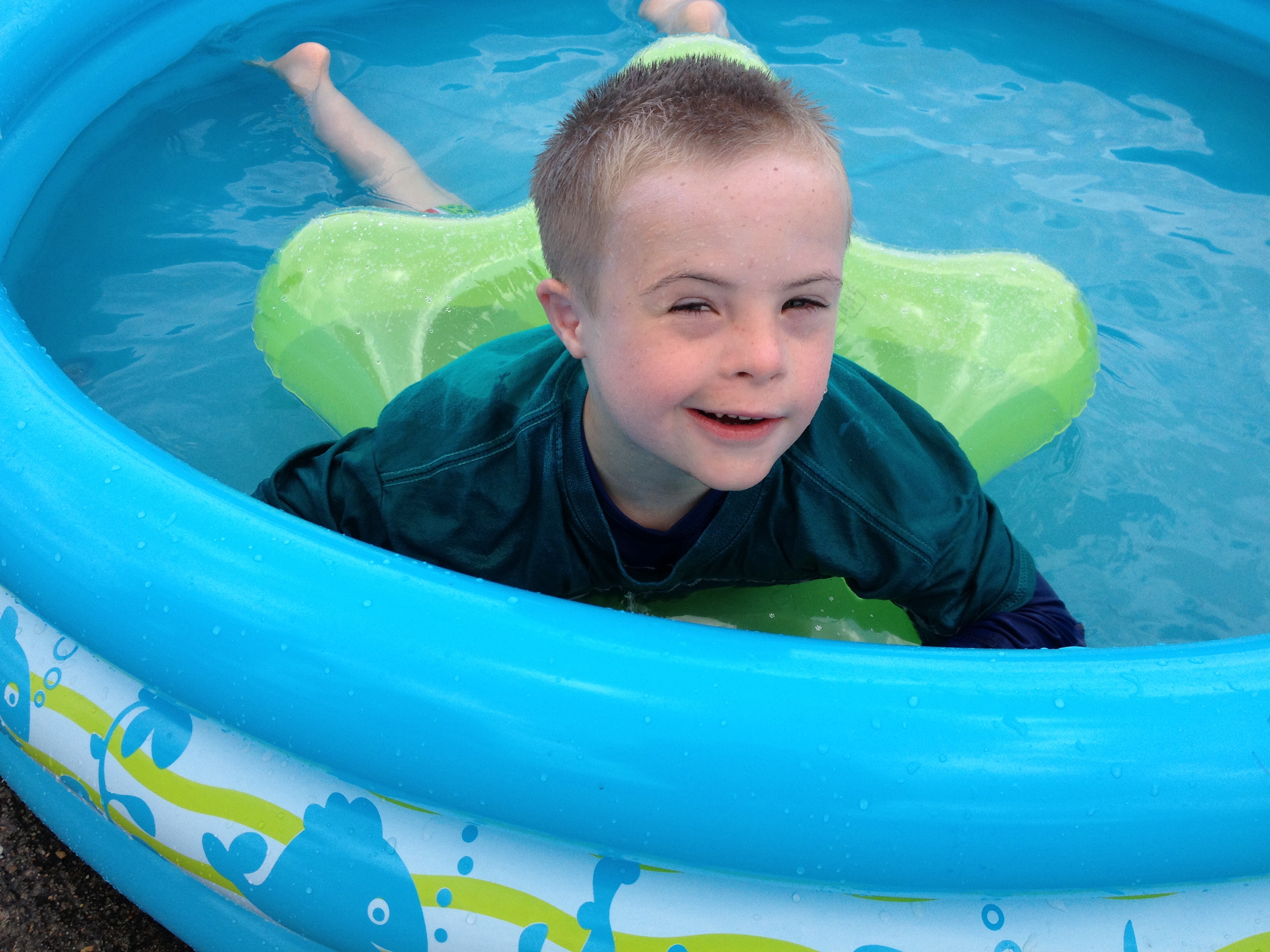 Why do all people with Downs Syndrome have the same face