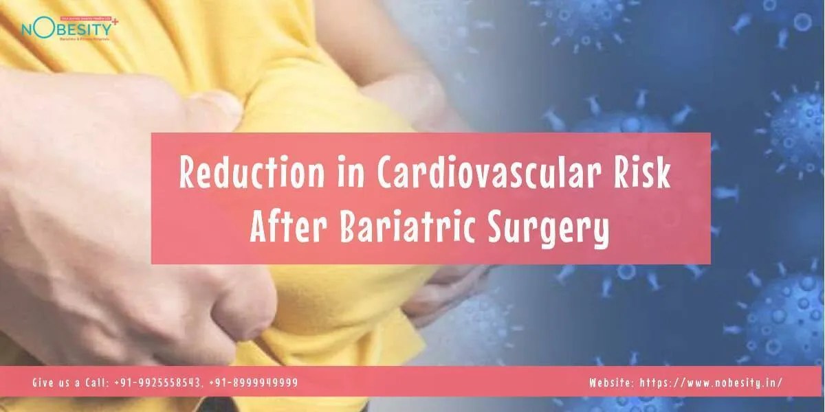 Reduction in Cardiovascular Risk After Bariatric Surgery Nobesity