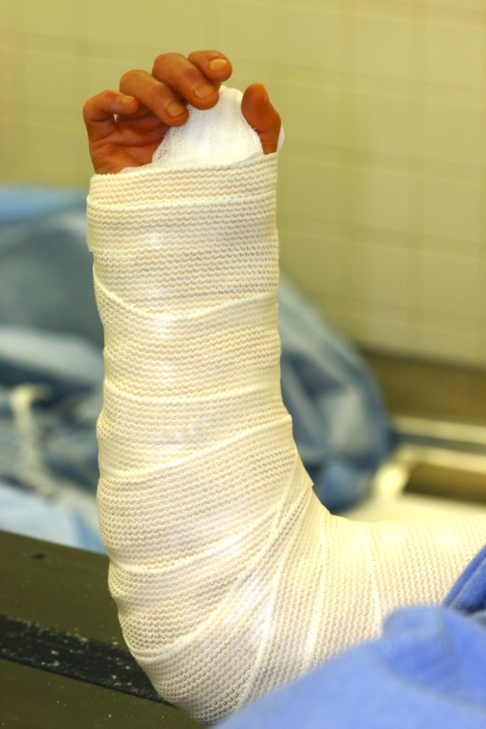 Instructions After Surgery