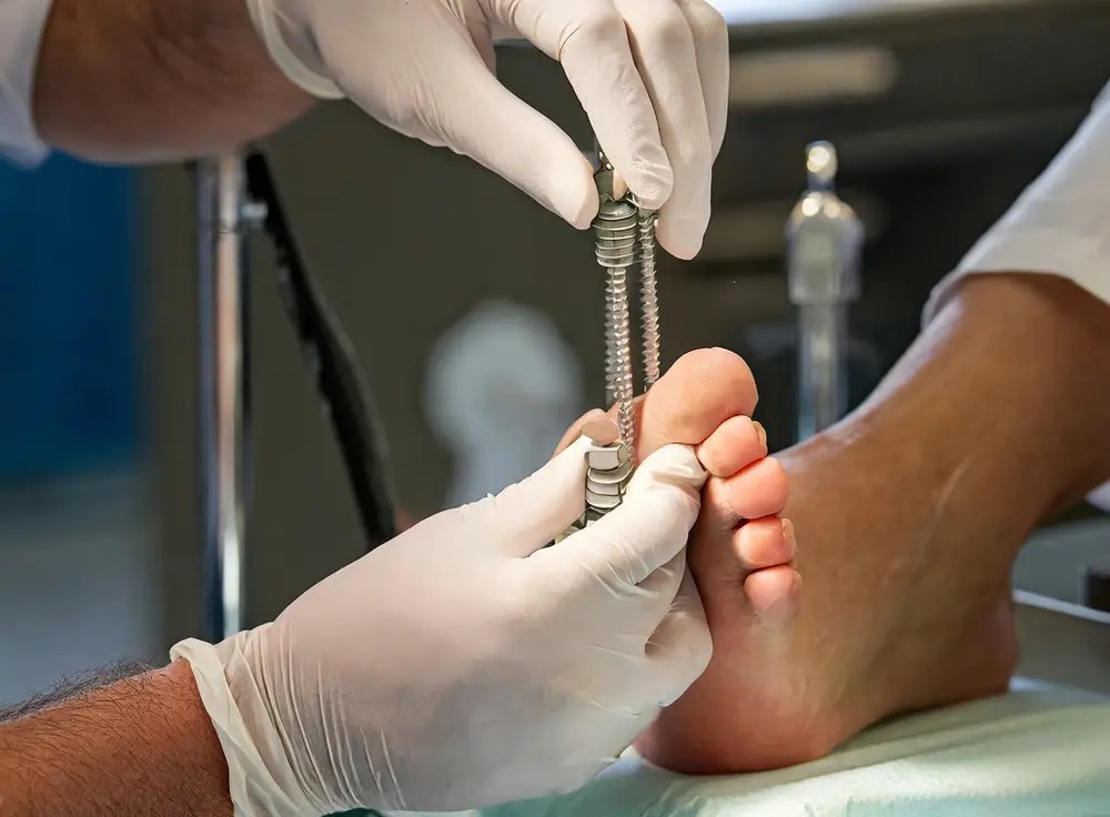 Understanding Foot Recovery with Surgical Screws Northern Ankle Foot