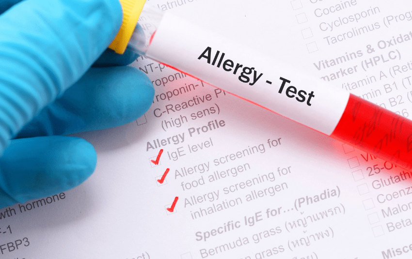 List of Allergy Tests Available ENT